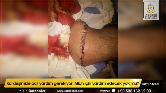 Kardeşimize acil yardım gerekiyor. Allah için yardım edecek yok mu 05