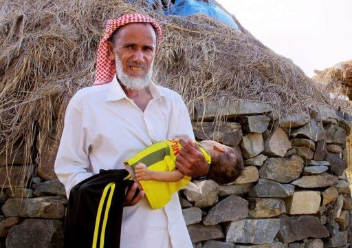 Yemen Yardımını bekliyor 06