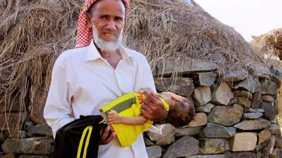 Yemen Yardımını bekliyor 06