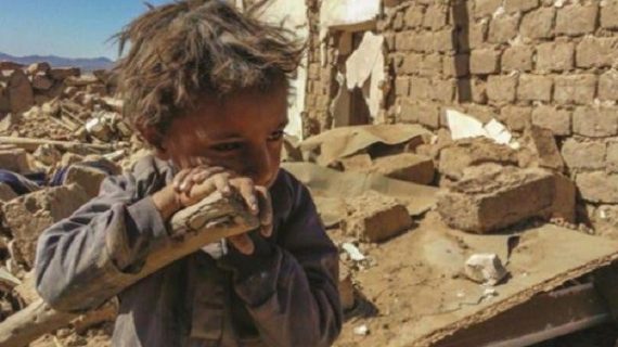 Yemen Yardımını bekliyor 13