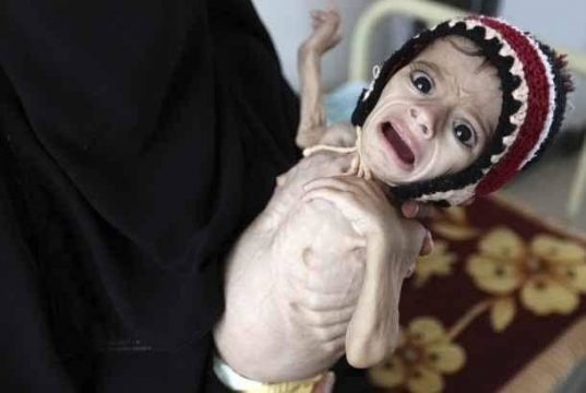 Yemen Yardımını bekliyor 15