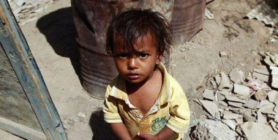 Yemen Yardımını bekliyor 17