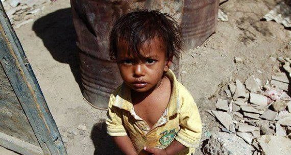 Yemen Yardımını bekliyor 17
