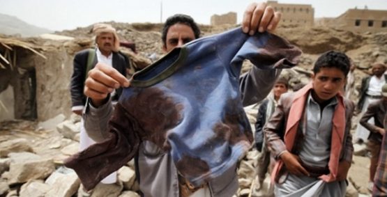 Yemen Yardımını bekliyor 21
