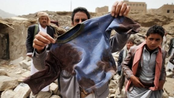 Yemen Yardımını bekliyor 21