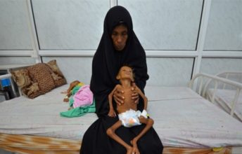 Yemen Yardımını bekliyor 23