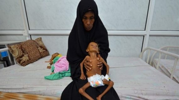 Yemen Yardımını bekliyor 23