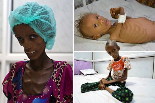 Yemen Yardımını bekliyor 26