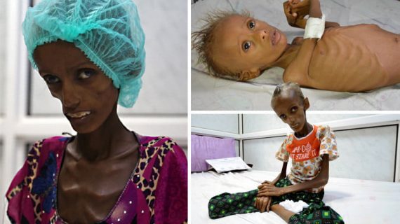 Yemen Yardımını bekliyor 26