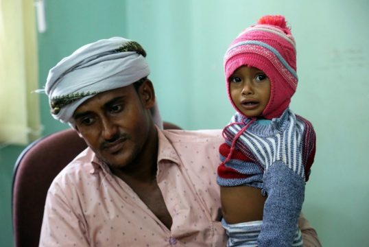 Yemen Yardımını bekliyor 27