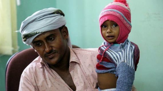 Yemen Yardımını bekliyor 27