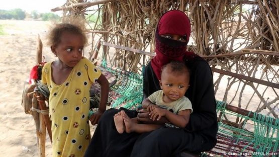 Yemen Yardımını bekliyor 33