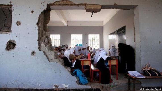 Yemen Yardımını bekliyor 34