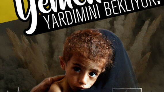 Yemen Yardımını bekliyor 37