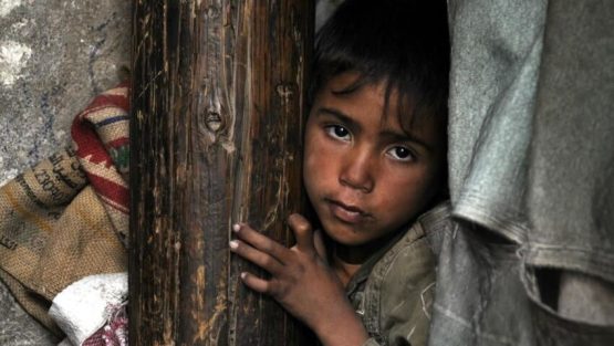 Yemen Yardımını bekliyor 16