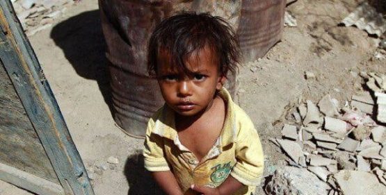 Yemen Yardımını bekliyor 17