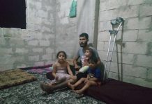 acil yardim tedavi edilmezse ayagi kesilecek 01