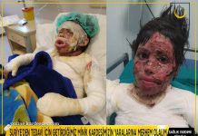 suriye den tedavi icin getirdigimiz minik kardesimizin yaralarina merhem olalim 01