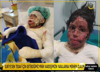 suriye den tedavi icin getirdigimiz minik kardesimizin yaralarina merhem olalim 01